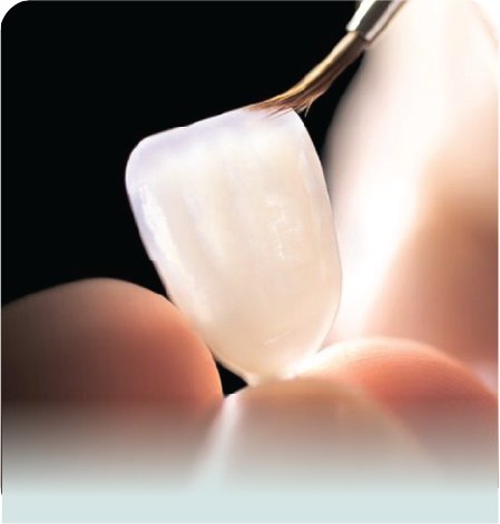 مراقبت‌های مهم پس از روکش دندان؛ افزایش عمر روکش